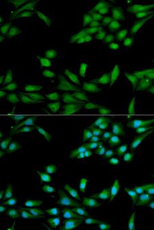 MSH2 Antibody - Immunofluorescence analysis of HeLa cell using MSH2 antibody. Blue: DAPI for nuclear staining.