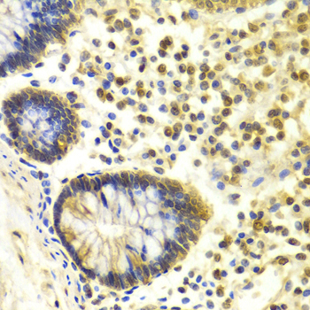 MSH2 Antibody - Immunohistochemistry of paraffin-embedded Human colon tissue.