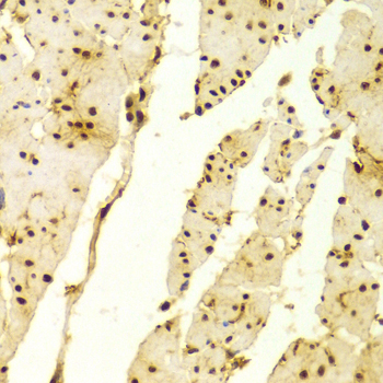 MSH2 Antibody - Immunohistochemistry of paraffin-embedded Human esophageal tissue.