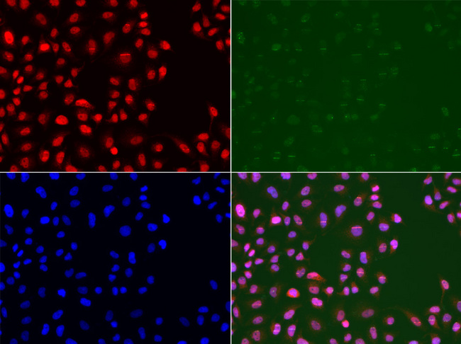 MSH2 Antibody - Immunofluorescence analysis of U2OS cells.