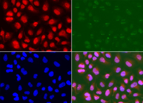 MSH2 Antibody - Immunofluorescence analysis of U2OS cells.
