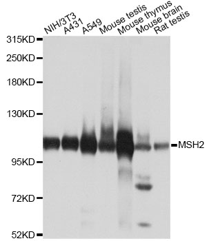 MSH2 Antibody - Western blot analysis of extracts of various cell lines, using MSH2 antibody at 1:1000 dilution. The secondary antibody used was an HRP Goat Anti-Rabbit IgG (H+L) at 1:10000 dilution. Lysates were loaded 25ug per lane and 3% nonfat dry milk in TBST was used for blocking. An ECL Kit was used for detection and the exposure time was 10s.
