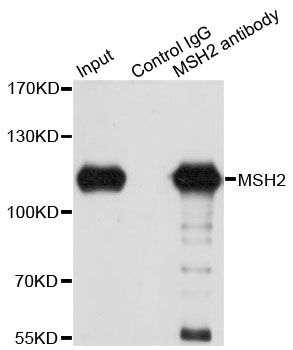 MSH2 Antibody - Immunoprecipitation analysis of 150ug extracts of A549 cells using 3ug MSH2 antibody. Western blot was performed from the immunoprecipitate using MSH2 antibodyat a dilition of 1:1000.