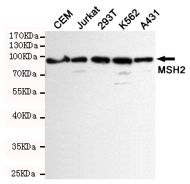 MSH2 Antibody - Western blot detection of MSH2 in K562, CEM, Jurkat, 293T and A431 cell lysates using MSH2 mouse monoclonal antibody (1:1000 dilution). Predicted band size: 100KDa. Observed band size:100KDa.