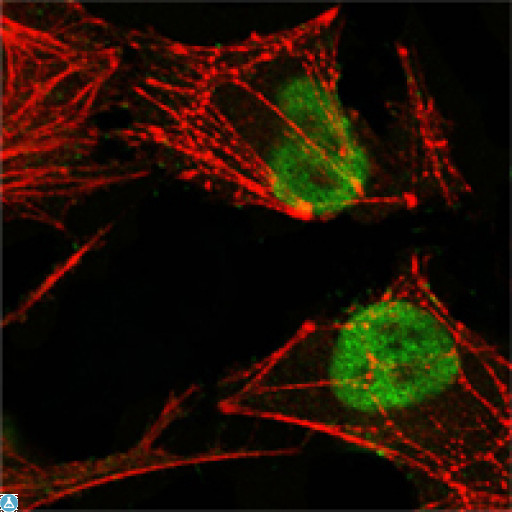 MSH2 Antibody - Confocal Immunofluorescence (IF) analysis of HeLa cells using MSH2 Monoclonal Antibody (green), showing nuclear localization. Red: Actin filaments have been labeled with Alexa Fluor-555 phalloidin.