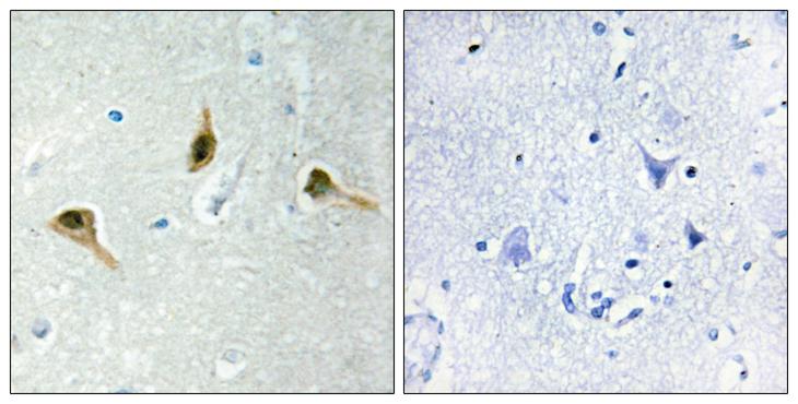 MSH2 Antibody - Peptide - + Immunohistochemistry analysis of paraffin-embedded human brain tissue using MSH2 antibody.