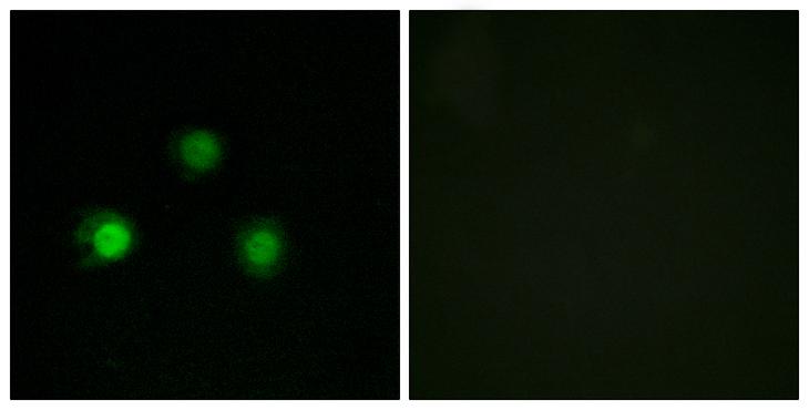 MSH2 Antibody - Peptide - + Immunofluorescence analysis of HUVEC cells, using MSH2 antibody.