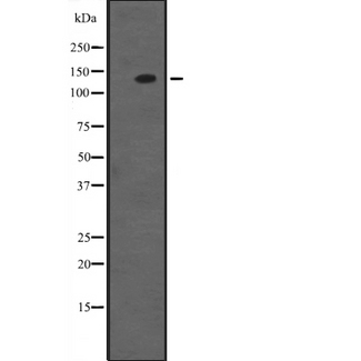 MSH3 Antibody - Western blot analysis of MSH3 expression in A549 whole cells lysate. The lane on the left is treated with the antigen-specific peptide.