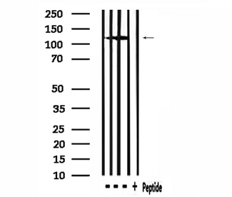 MSH3 Antibody - Western blot analysis of extracts of rat brain, mouse brain tissue using MSH3 antibody.