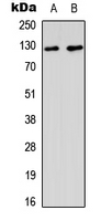MSH3 Antibody - Western blot analysis of MSH3 expression in A549 (A); HeLa (B) whole cell lysates.