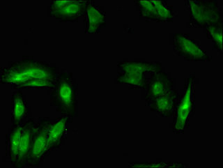 MSH4 Antibody - Immunofluorescent analysis of Hela cells using MSH4 Antibody at dilution of 1:100 and Alexa Fluor 488-congugated AffiniPure Goat Anti-Rabbit IgG(H+L)