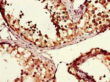 MSH4 Antibody - Immunohistochemistry of paraffin-embedded human testis tissue using MSH4 Antibody at dilution of 1:100