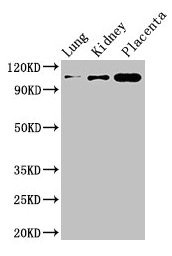 MSH4 Antibody - Western Blot Positive WB detected in: Mouse lung tissue, Mouse kidney tissue, Mouse skeletal muscle tissue All lanes: MSH4 antibody at 3µg/ml Secondary Goat polyclonal to rabbit IgG at 1/50000 dilution Predicted band size: 105 kDa Observed band size: 105 kDa
