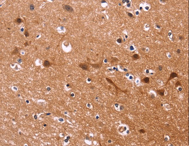 MSH4 Antibody - Immunohistochemistry of paraffin-embedded Human brain using MSH4 Polyclonal Antibody at dilution of 1:30.