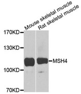 MSH4 Antibody - Western blot analysis of extracts of various cells.