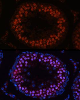 MSH4 Antibody - Immunofluorescence analysis of rat testis using MSH4 antibody at dilution of 1:100 (40x lens). Blue: DAPI for nuclear staining.