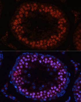 MSH4 Antibody - Immunofluorescence analysis of Rat testis using MSH4 Polyclonal Antibody at dilution of 1:100.Blue: DAPI for nuclear staining.