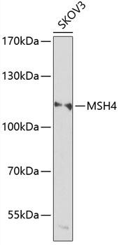 MSH4 Antibody - Western blot analysis of extracts of SKOV3 cells using MSH4 Polyclonal Antibody at dilution of 1:1000.