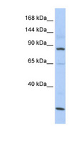 MSH5 Antibody - MSH5 antibody Western blot of HepG2 cell lysate. This image was taken for the unconjugated form of this product. Other forms have not been tested.
