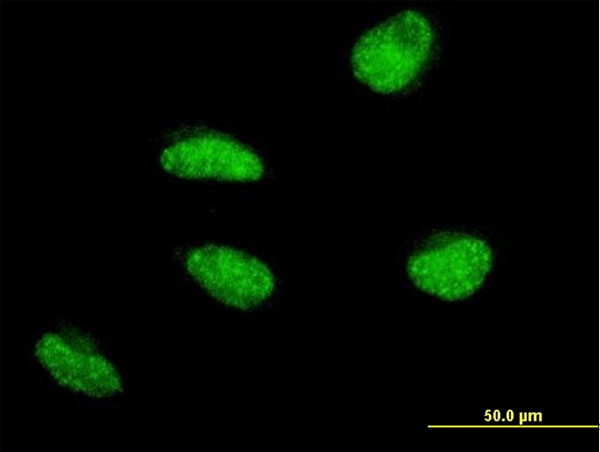 MSH5 Antibody - Immunofluorescence of monoclonal antibody to MSH5 on HeLa cell . [antibody concentration 10 ug/ml]