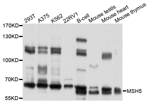 MSH5 Antibody - Western blot analysis of extracts of various cell lines, using MSH5 antibody at 1:1000 dilution. The secondary antibody used was an HRP Goat Anti-Rabbit IgG (H+L) at 1:10000 dilution. Lysates were loaded 25ug per lane and 3% nonfat dry milk in TBST was used for blocking. An ECL Kit was used for detection and the exposure time was 30s.