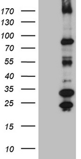 MSH6 Antibody - HEK293T cells were transfected with the pCMV6-ENTRY control. (Left lane) or pCMV6-ENTRY MSH6. (Right lane) cDNA for 48 hrs and lysed. Equivalent amounts of cell lysates. (5 ug per lane) were separated by SDS-PAGE and immunoblotted with anti-MSH6. (1:2000)