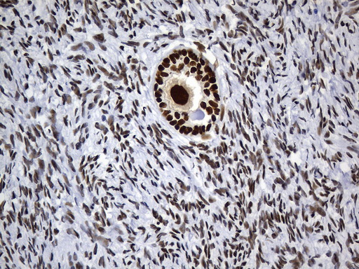 MSH6 Antibody - Immunohistochemical staining of paraffin-embedded human ovary within the normal limits using anti-MSH6 mouse monoclonal antibody. (Heat-induced epitope retrieval by 1mM EDTA in 10mM Tris buffer. (pH9.0) at 120°C for 3 min. (1:50)