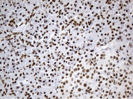MSH6 Antibody - Immunohistochemical staining of paraffin-embedded human pancreas tissue within the normal limits using anti-MSH6 mouse monoclonal antibody. (Heat-induced epitope retrieval by 1mM EDTA in 10mM Tris buffer. (pH9.0) at 120°C for 3 min. (1:50)