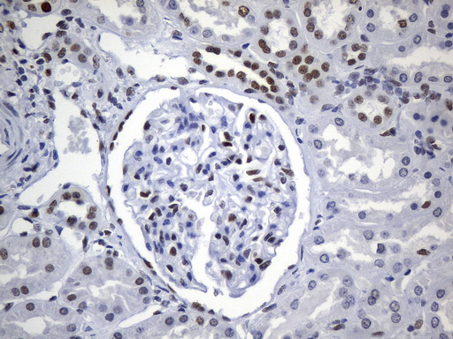 MSH6 Antibody - Immunohistochemical staining of paraffin-embedded human kidney tissue within the normal limits using anti-MSH6 mouse monoclonal antibody. (Heat-induced epitope retrieval by 1mM EDTA in 10mM Tris buffer. (pH9.0) at 120°C for 3 min. (1:50)