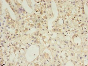 MSH6 Antibody - Immunohistochemistry of paraffin-embedded human adrenal gland using antibody at 1:100 dilution.  This image was taken for the unconjugated form of this product. Other forms have not been tested.