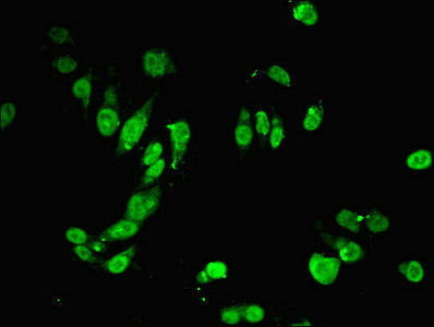 MSH6 Antibody - Immunofluorescent analysis of Hela cells using MSH6 Antibody at dilution of 1:100 and Alexa Fluor 488-congugated AffiniPure Goat Anti-Rabbit IgG(H+L)
