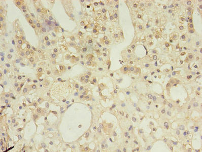 MSH6 Antibody - Immunohistochemistry of paraffin-embedded human adrenal gland tissue using MSH6 Antibody at dilution of 1:100