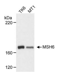 MSH6 Antibody - Detection of Human MSH6 by Western Blot. Samples: Whole cell lysate (30 ug) from human lymphoblast TK6 (wild type MSH6 expression) or MT1 (TK6 derived cells with reduced expression of a mutant MSH6). Antibody: Affinity purified rabbit anti-MSH6 used at 0.2 ug/ml. Detection: Chemiluminescence with 10 second exposure.