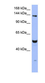 MSH6 Antibody - MSH6 antibody Western blot of THP-1 cell lysate. This image was taken for the unconjugated form of this product. Other forms have not been tested.