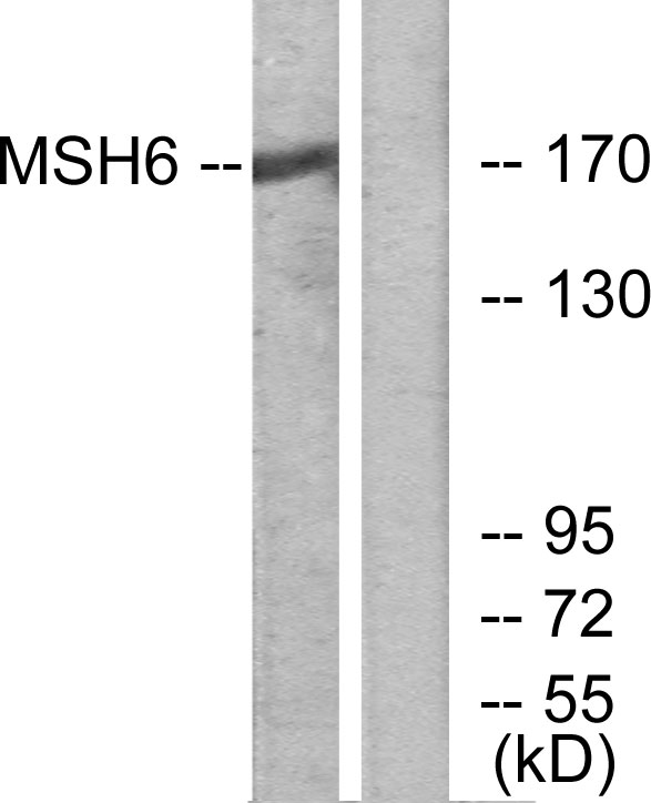 MSH6 Antibody - Western blot analysis of lysates from HUVEC cells, using MSH6 Antibody. The lane on the right is blocked with the synthesized peptide.