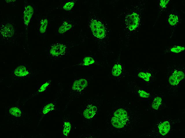 MSH6 Antibody - Immunofluorescence staining of MSH6 in HeLa cells. Cells were fixed with 4% PFA, permeabilzed with 0.1% Triton X-100 in PBS, blocked with 10% serum, and incubated with rabbit anti-human MSH6 monoclonal antibody (dilution ratio 1:60) at 4°C overnight. Then cells were stained with the Alexa Fluor 488-conjugated Goat Anti-rabbit IgG secondary antibody (green). Positive staining was localized to Nucleus.