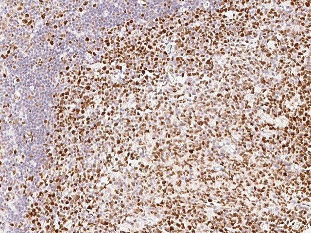 MSH6 Antibody - Immunochemical staining of human MSH6 in human tonsil with rabbit monoclonal antibody at 1:200 dilution, formalin-fixed paraffin embedded sections.