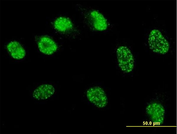 MSH6 Antibody - Immunofluorescence of monoclonal antibody to MSH6 on HeLa cell . [antibody concentration 10 ug/ml]
