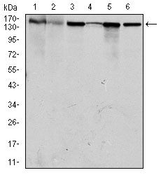 MSH6 Antibody - Western blot using MSH6 mouse monoclonal antibody against HEK293 (1), HCT116 (2), A549 (3), A431 (4), MCF-7 (5) and HepG2 (6) cell lysate.