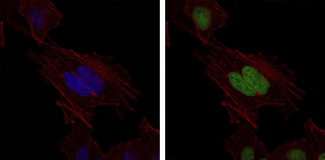 MSH6 Antibody - Immunofluorescence of HeLa cells using MSH6 mouse monoclonal antibody (green). Blue: DRAQ5 fluorescent DNA dye. Red: Actin filaments have been labeled with Alexa Fluor-555 phalloidin.