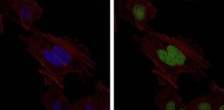 MSH6 Antibody - MSH6 Antibody in Immunofluorescence (IF)