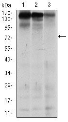 MSH6 Antibody - MSH6 Antibody in Western Blot (WB)