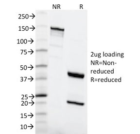 MSH6 Antibody - SDS-PAGE analysis of purified, BSA-free MSH6 antibody (clone MSH6/2111) as confirmation of integrity and purity.