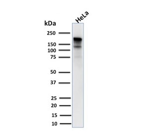 MSH6 Antibody - Western blot testing of human HeLa lysate with MSH6 antibody (clone MSH6/3085). Predicted molecular weight ~160 kDa.