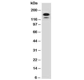 MSH6 Antibody - Western blot testing of human HeLa lysate with MSH6 antibody (clone MTS6-1). Predicted molecular weight ~160 kDa.