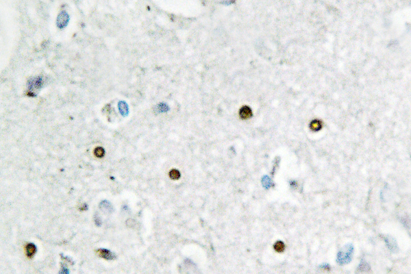 MSH6 Antibody - IHC of GTBP (E371) pAb in paraffin-embedded human brain tissue.
