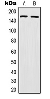 MSH6 Antibody - Western blot analysis of MSH6 expression in HeLa (A); HCT116 (B) whole cell lysates.
