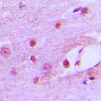 MSH6 Antibody - Immunohistochemical analysis of MSH6 staining in human brain formalin fixed paraffin embedded tissue section. The section was pre-treated using heat mediated antigen retrieval with sodium citrate buffer (pH 6.0). The section was then incubated with the antibody at room temperature and detected using an HRP conjugated compact polymer system. DAB was used as the chromogen. The section was then counterstained with hematoxylin and mounted with DPX.