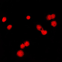 MSH6 Antibody - Immunofluorescent analysis of MSH6 staining in HeLa cells. Formalin-fixed cells were permeabilized with 0.1% Triton X-100 in TBS for 5-10 minutes and blocked with 3% BSA-PBS for 30 minutes at room temperature. Cells were probed with the primary antibody in 3% BSA-PBS and incubated overnight at 4 C in a humidified chamber. Cells were washed with PBST and incubated with a DyLight 594-conjugated secondary antibody (red) in PBS at room temperature in the dark. DAPI was used to stain the cell nuclei (blue).