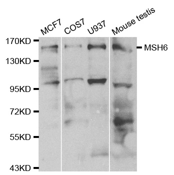 MSH6 Antibody - Western blot analysis of extracts of various cell lines, using MSH6 antibody at 1:500 dilution. The secondary antibody used was an HRP Goat Anti-Rabbit IgG (H+L) at 1:10000 dilution. Lysates were loaded 25ug per lane and 3% nonfat dry milk in TBST was used for blocking.